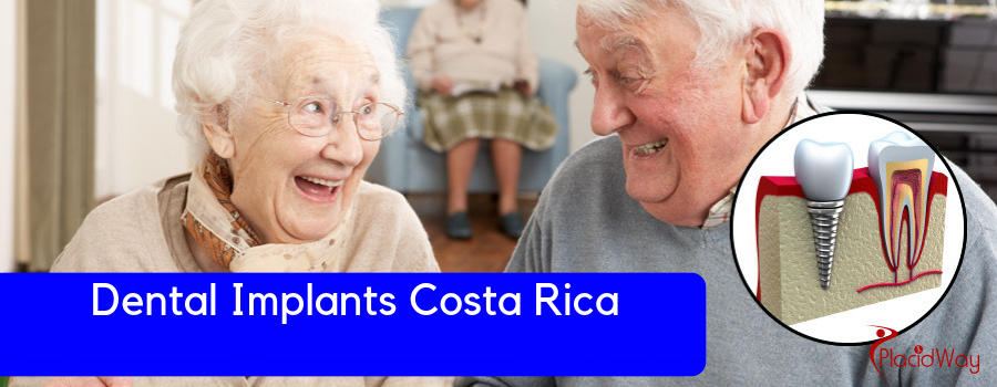 Dental Implants Cost in Costa Rica